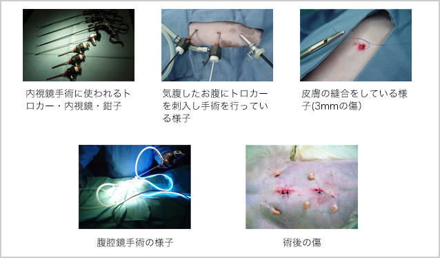腹腔鏡下手術の基本的な手順